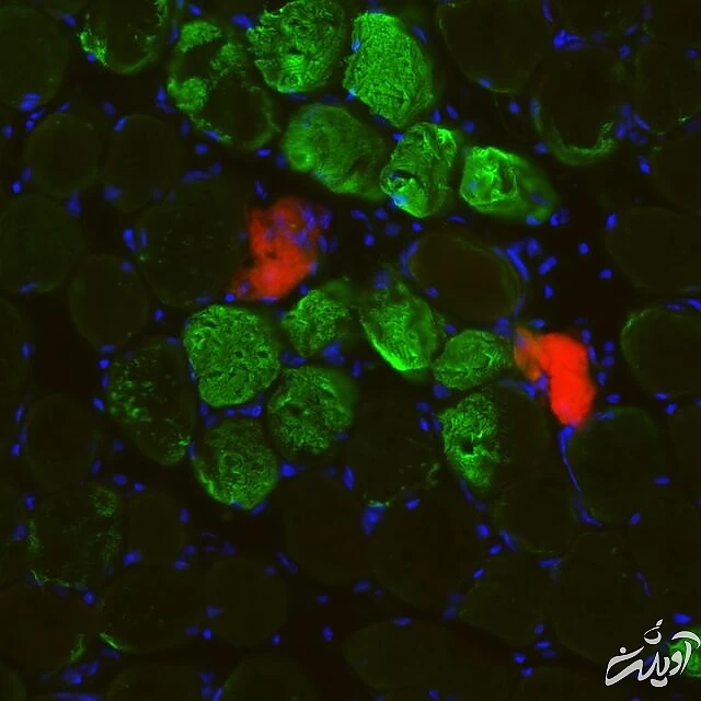 کشف یک مکانیسم مهم که در ترمیم سریع عضلات نقش دارد